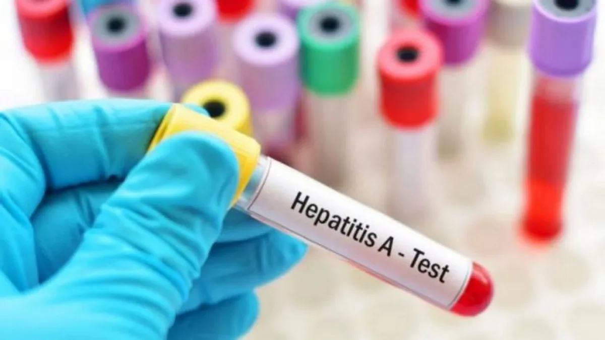 Hepatitis-A-Ausbruch in der Slowakei Das ist der Stand vom 8. August 2025