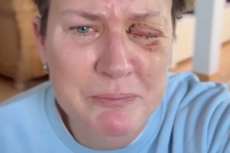 Andrea Plewig verliert Augenlicht nach Feuerwerksunfall