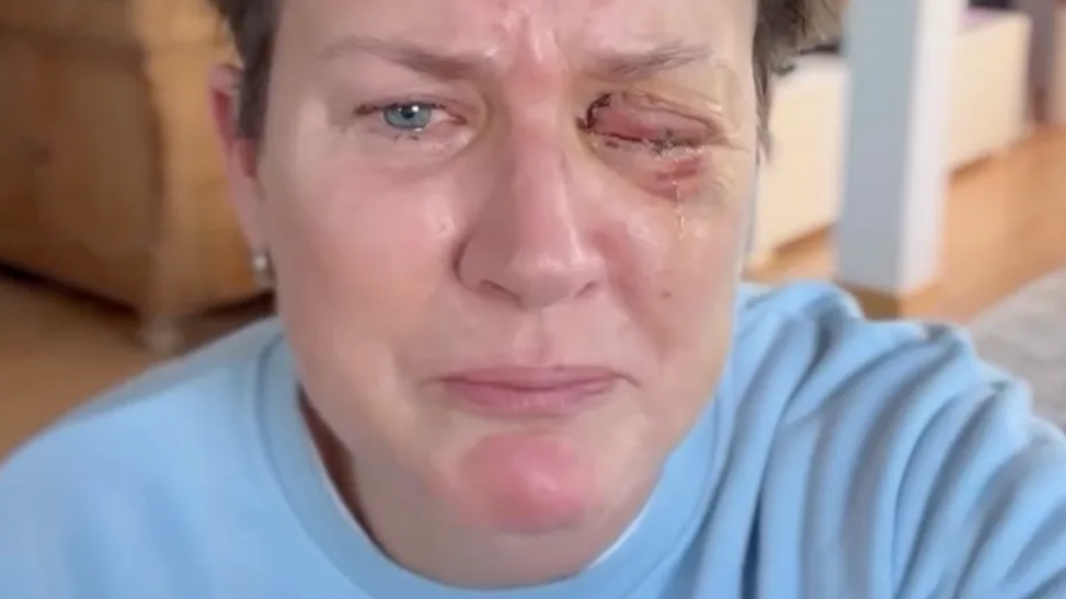 Andrea Plewig verliert Augenlicht nach Feuerwerksunfall