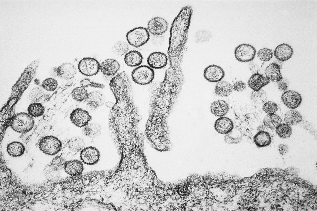 Hantavirus auf Kreuzfahrtschiff: Symptome, Übertragung und ob es Fälle in Deutschland gibt